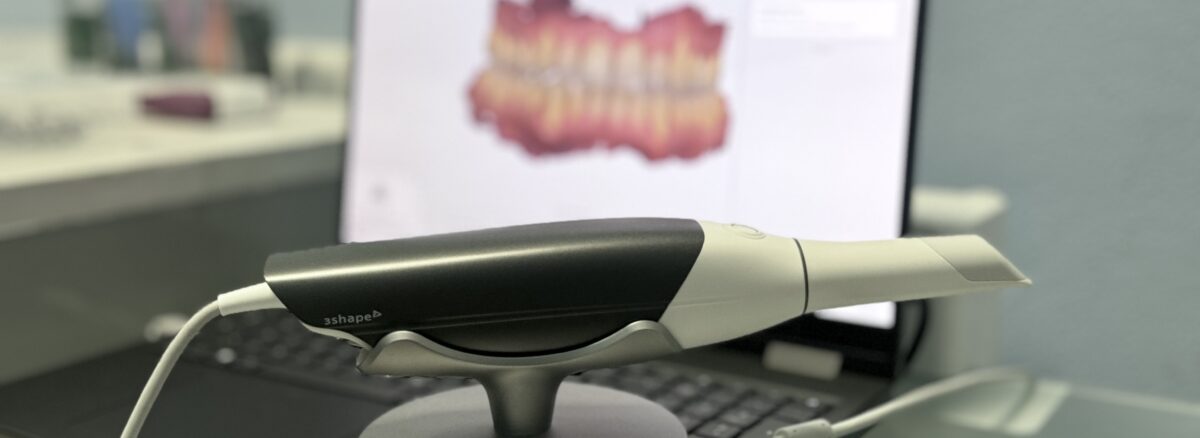 Studio odontoiatrico scarozza dentista San Giovanni roma 3shape scanner intraorale impronta digitale
