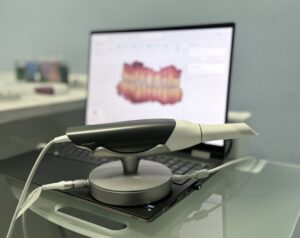 Studio odontoiatrico scarozza dentista San Giovanni roma 3shape scanner intraorale impronta digitale 