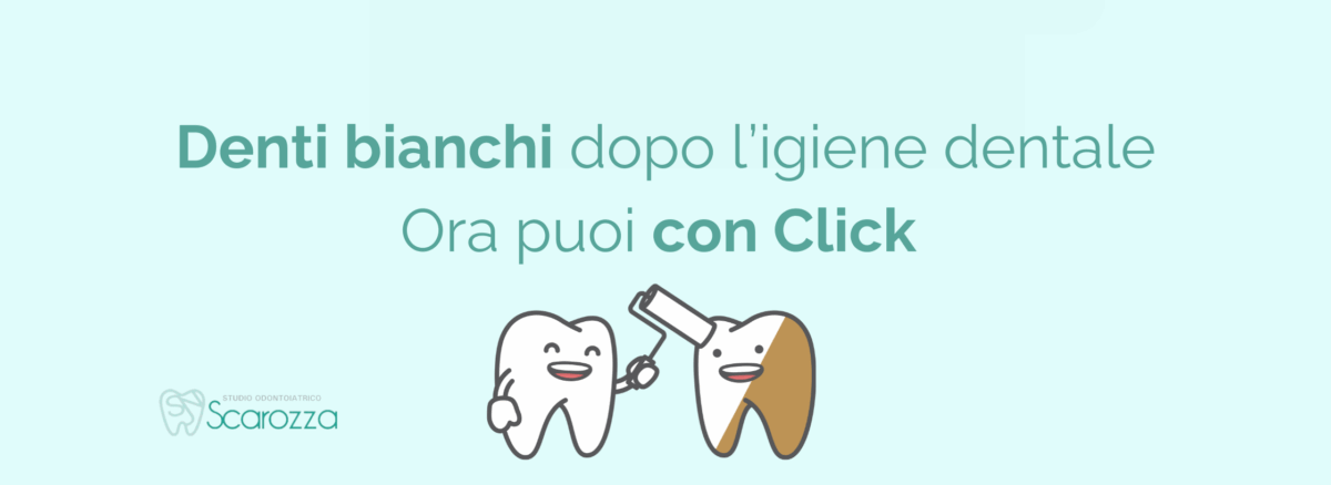 denti bianchi dopo l'igiene