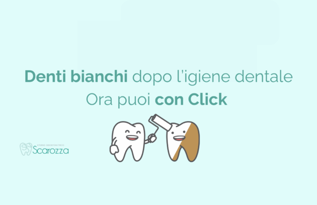denti bianchi dopo l'igiene